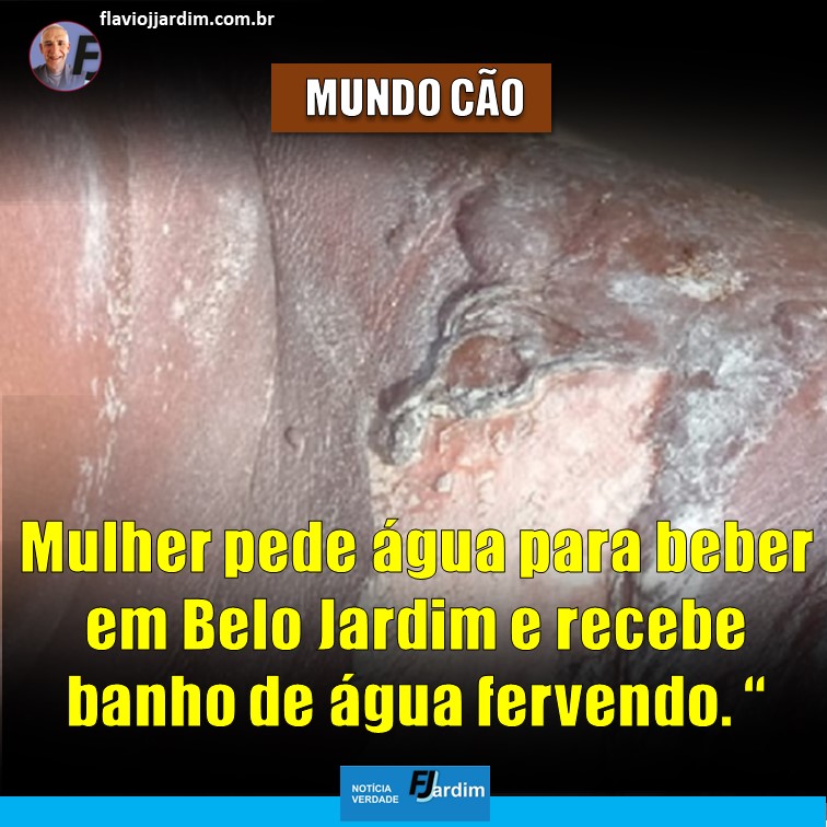 ÁGUA FERVENDO | Mulher pede água pra beber e recebe um banho de água fervendo em Belo Jardim