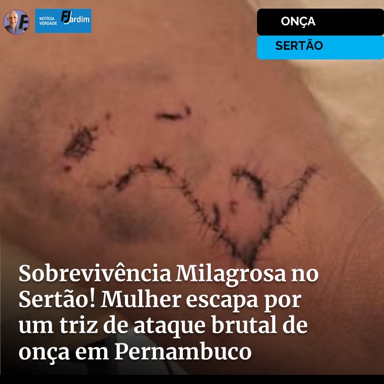 ONÇA | Sobrevivência Milagrosa no Sertão! Mulher Escapa por um Triz de Ataque Brutal de Onça em Pernambuco