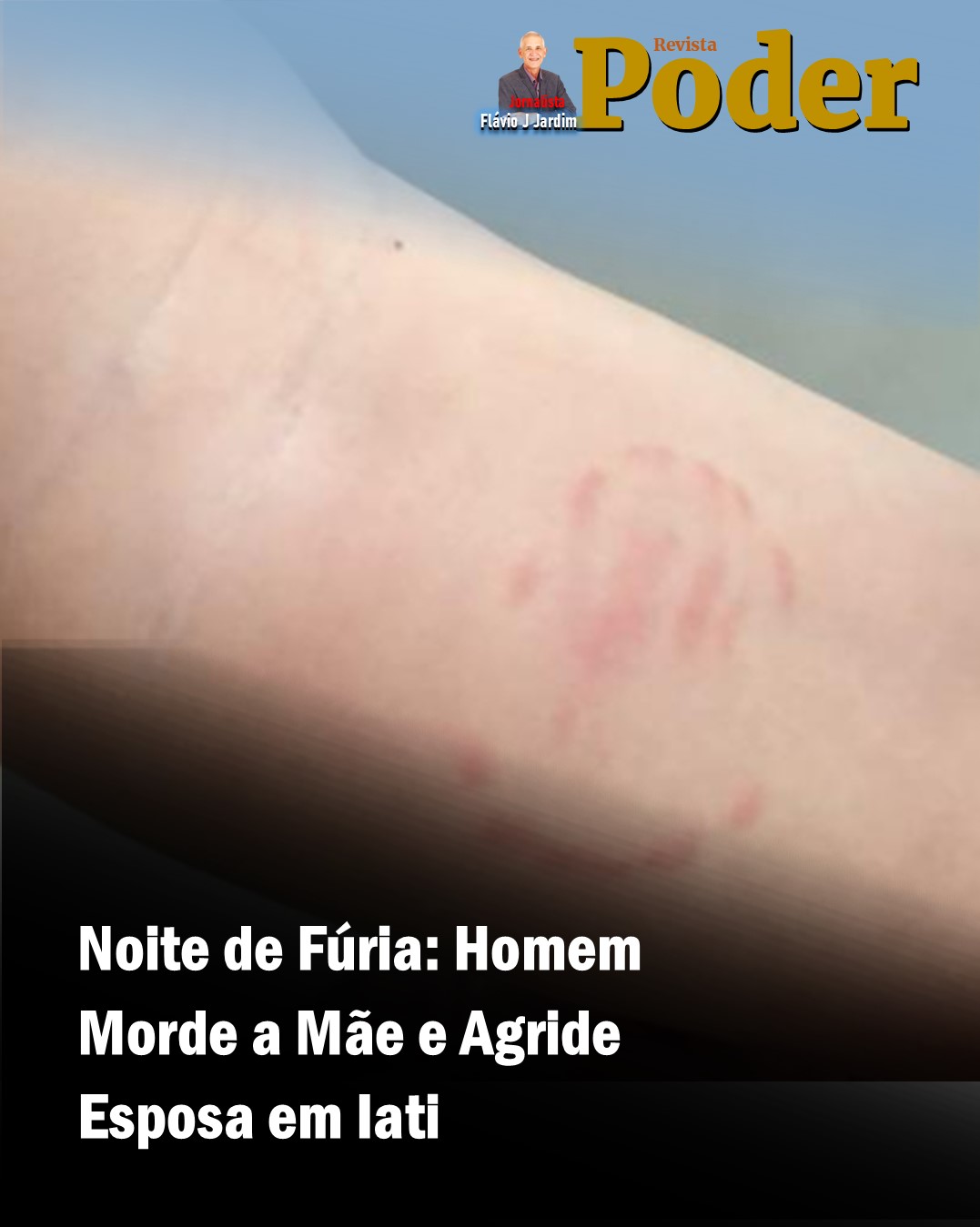 🩸 Noite de Fúria: Homem Morde a Mãe e Agride Esposa em Iati