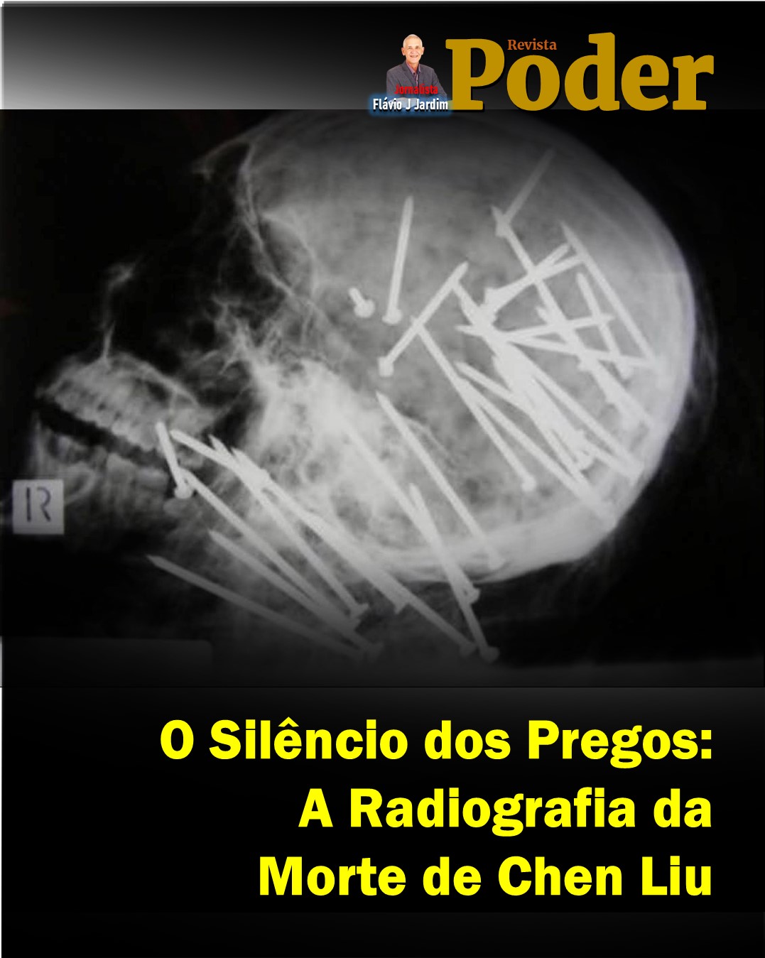 🔩 O Silêncio dos Pregos: A Radiografia da Morte de Chen Liu