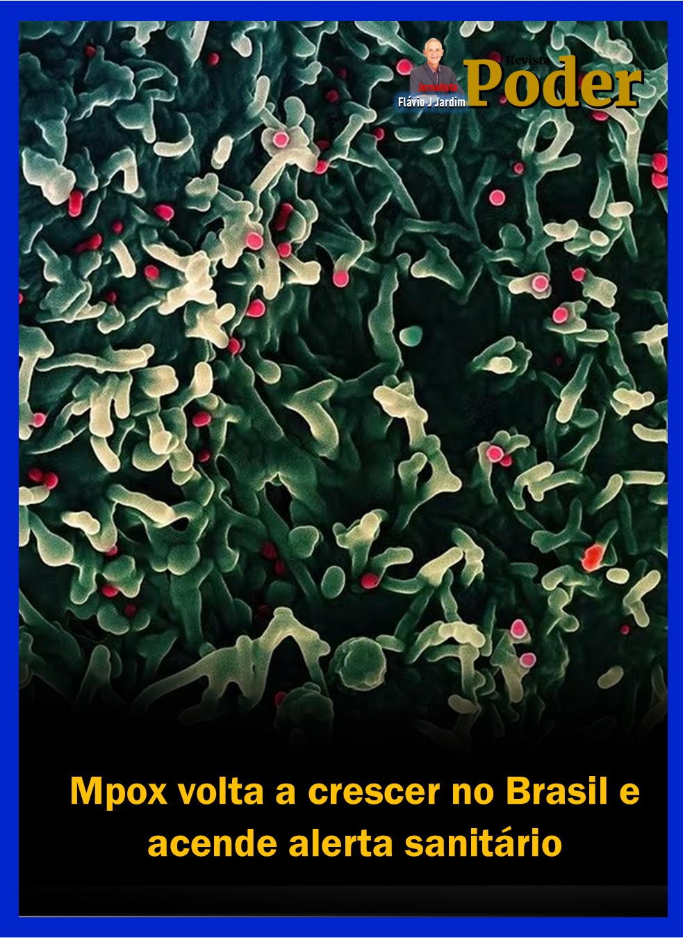 Mpox volta a crescer no Brasil e acende alerta sanitário