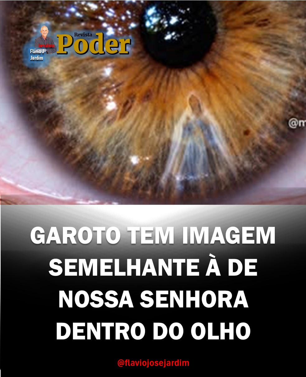 MISTÉRIO IMPRESSIONANTE! GAROTO TEM IMAGEM SEMELHANTE À DE NOSSA SENHORA DENTRO DO OLHO E INTRIGA O BRASIL